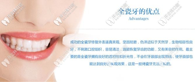 全瓷牙的優(yōu)點(diǎn)