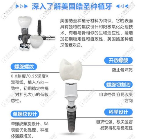 美國(guó)皓圣種植體