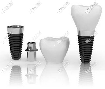 同為德國的種植體ht品牌和ankylos價格竟差......