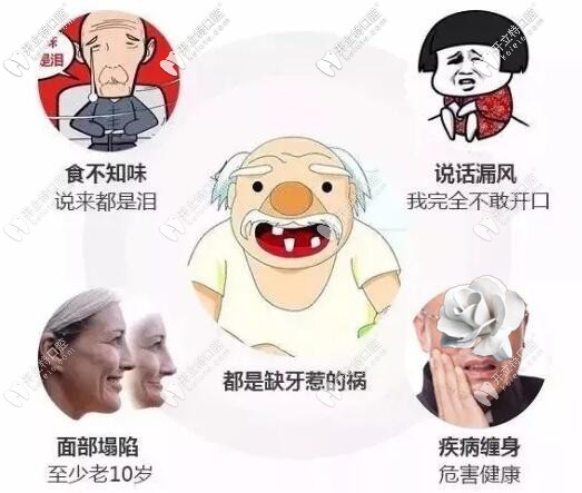 海口龍華鼎點口腔劉文彤醫(yī)生介紹牙齒缺失的危害有哪些