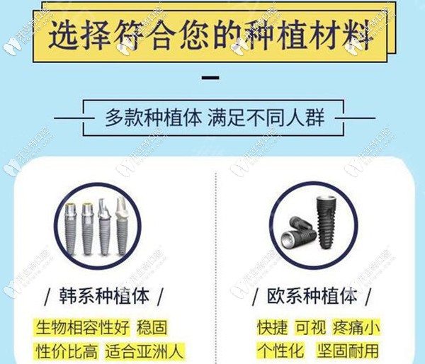 ?？诙c口腔韓系和歐系種植體