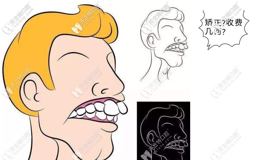 福州矯正牙套價(jià)目表里少不了隱適美和鋼牙矯正器收費(fèi)標(biāo)準(zhǔn)