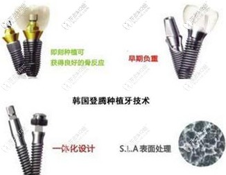 韓國登騰種植牙技術(shù)