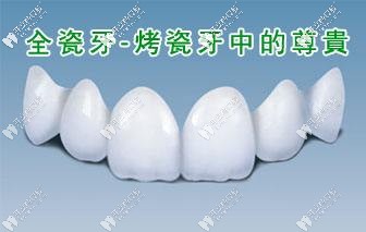 你知道國(guó)產(chǎn)品牌愛迪特全瓷牙的價(jià)格和材質(zhì)是啥子嘛