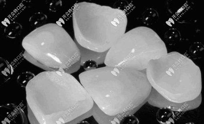 瓷貼面能用一輩子嗎?別傻了,速來了解義獲嘉瓷貼面的壽命