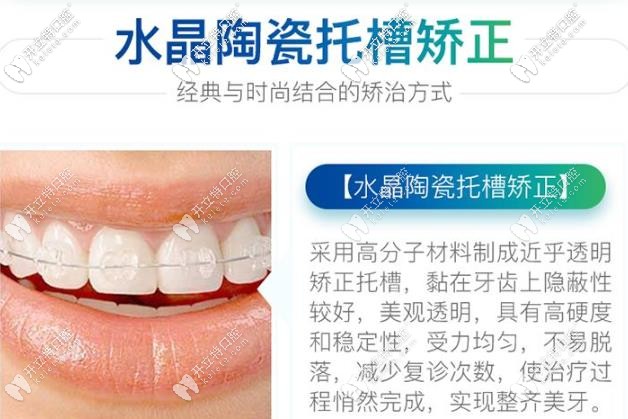 陶瓷半隱形矯正 陶瓷半隱形矯正