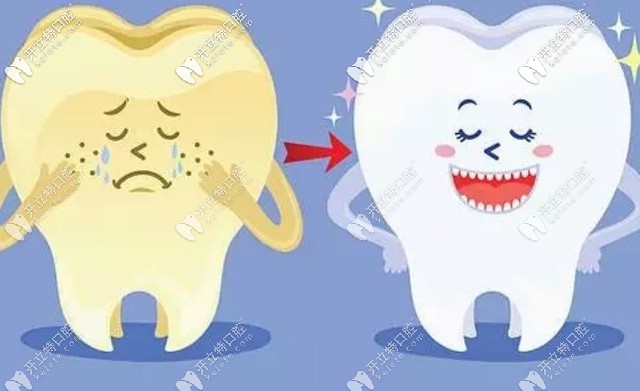 四環(huán)素牙如何美白