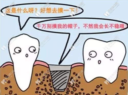 張少軍院長(zhǎng)講解種植牙術(shù)后的一些常見注意事項(xiàng)