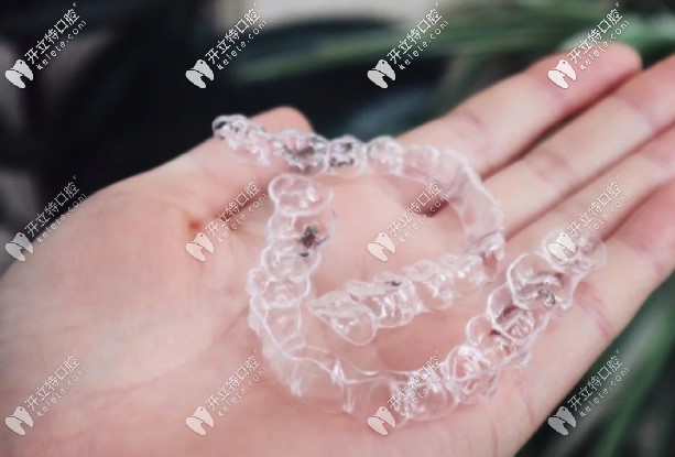 smilelab牙齒矯正靠譜嗎?戴笑盈隱形牙套整牙后來說說效果