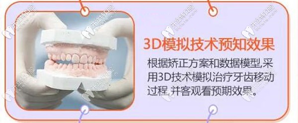 在?？诙c口腔做牙齒矯正前可先看效果