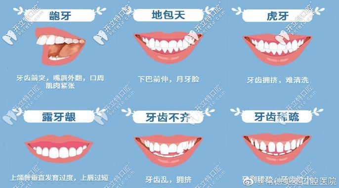 畸形的牙齒不僅僅影響臉型