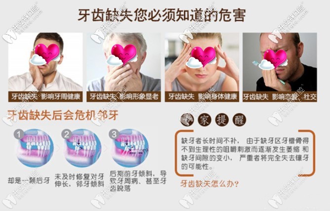 缺牙的危害是大大滴