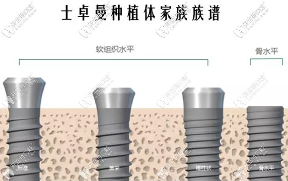 種植界的大神-瑞士士卓曼(ITI)種植牙多少錢一顆,你想知道嗎