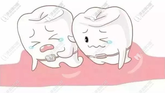 什么情況適合半口矯正呢？