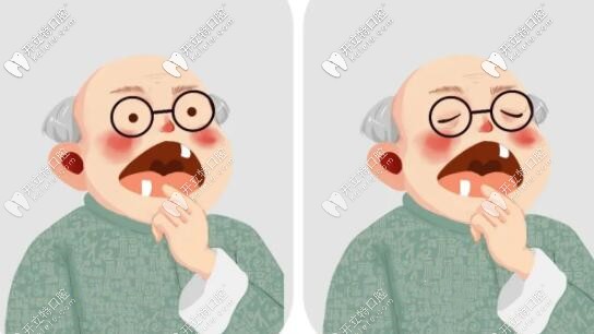 老爸在福州做登騰全口種植牙花了10多萬,誰來評價(jià)下效果