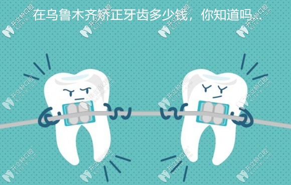 誰想在烏魯木齊矯正牙齒?我這有美奧牙科的收費價格可參考