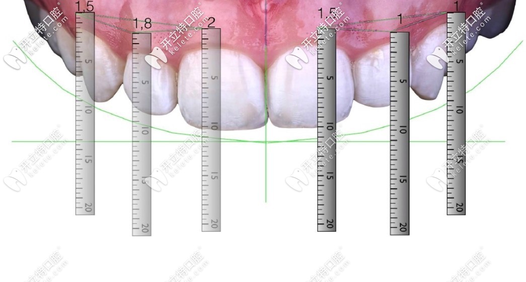 貼面的設(shè)計(jì)方案真不是隨隨便便滴