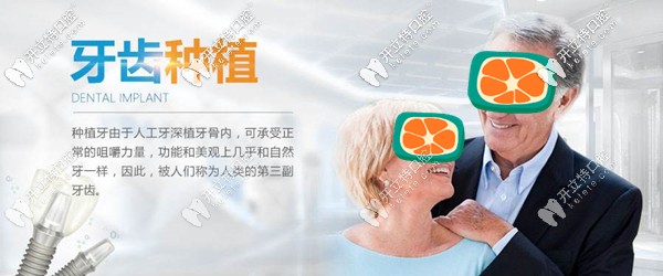 種植牙品牌 種植牙品牌