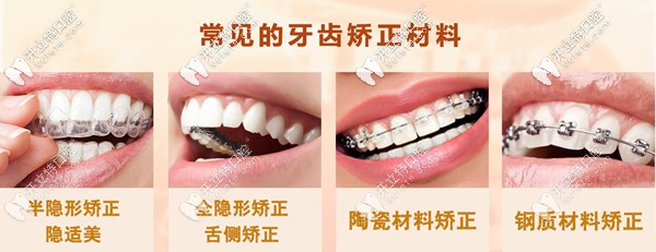 常見(jiàn)的牙齒矯正材料
