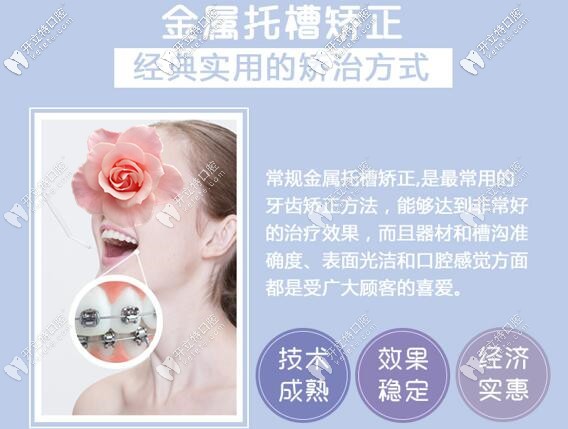 深圳微爾口腔金屬托槽牙齒矯正價(jià)格 深圳微爾口腔金屬托槽牙齒矯正價(jià)格