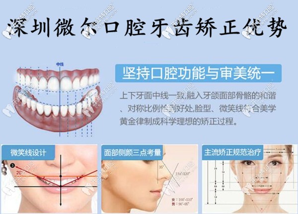 深圳微爾口腔牙齒矯正優(yōu)勢(shì) 深圳微爾口腔牙齒矯正優(yōu)勢(shì)