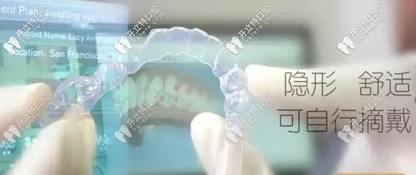 與傳統(tǒng)矯正相比隱形矯正有哪些優(yōu)勢？