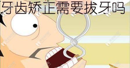 牙齒矯正都需要拔牙嗎