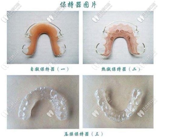 網(wǎng)上找的保持器圖片，我戴的是透明的保持器