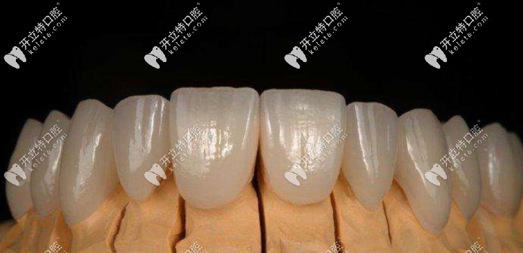 美加全瓷牙 美加全瓷牙