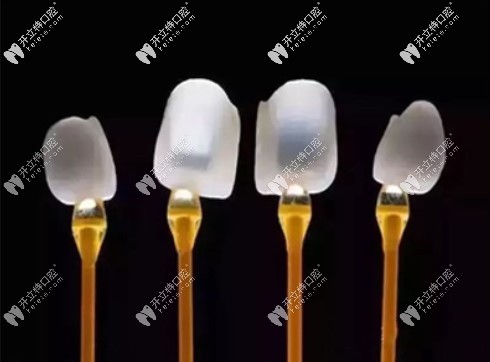 e-max貼面 e-max貼面