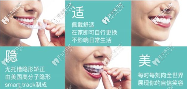 美國進(jìn)口隱適美隱形矯正