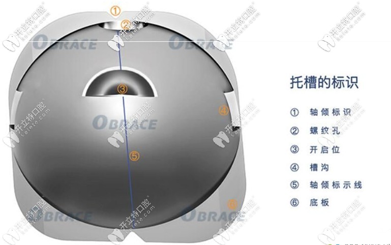 OBrace球面自鎖托槽技術(shù)