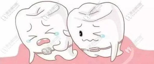 牙列不齊要盡快矯正 牙列不齊要盡快矯正