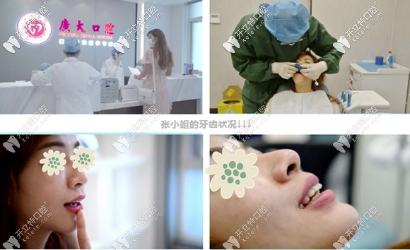 關于舌側矯正和唇側矯正的區(qū)別