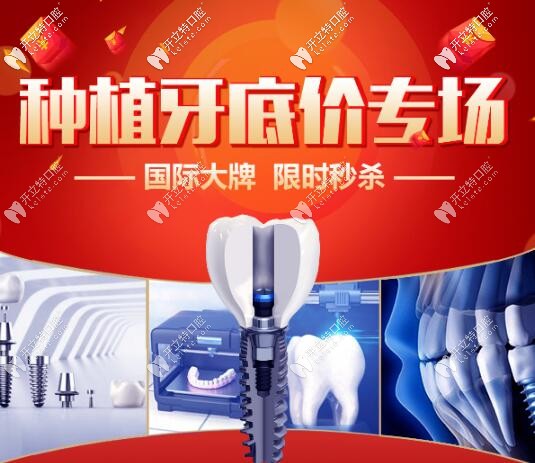 西安諾貝爾半口種植牙直降6萬,一顆2999元,收費(fèi)價格表這么低?