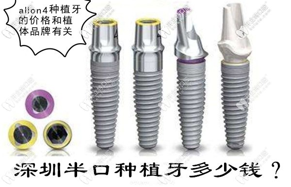 深圳allon4半口種植牙需要10萬嗎