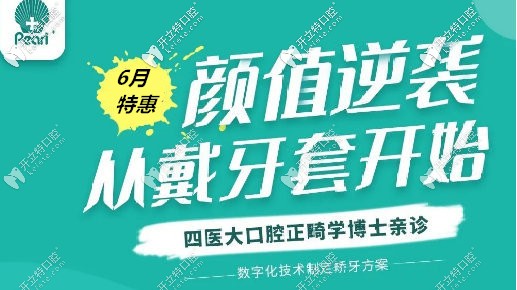 好嗨!西安正雅和進口陶瓷自鎖半隱形矯正價格竟然差不多