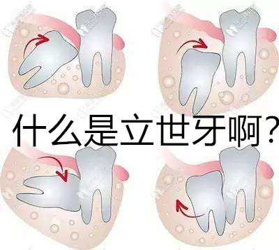 立世牙到底拔還是不拔?什么時候拔比較好及價格你都要知道