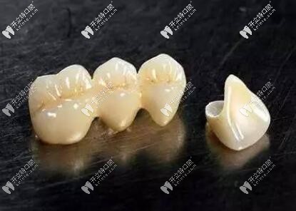 小診所愛爾創(chuàng)氧化鋯全瓷牙800一顆,你確定這是真的全瓷牙嗎