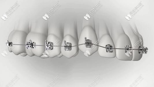 想知道在南京隱形整牙多少錢?有這份南京整牙價格表就夠了