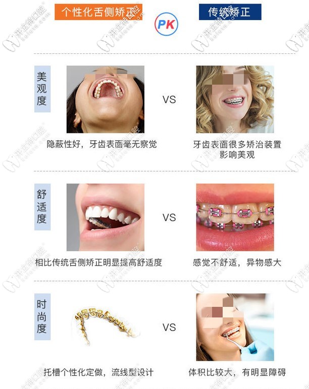 個(gè)性舌側(cè)隱形矯正和傳統(tǒng)矯正對(duì)比