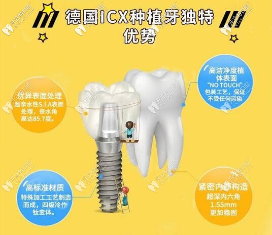 蘇州美奧德國ICX種植牙價格