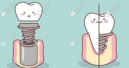 材料不同價格就不同