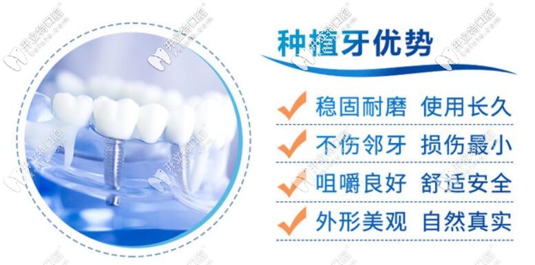 種植牙優(yōu)勢(shì)