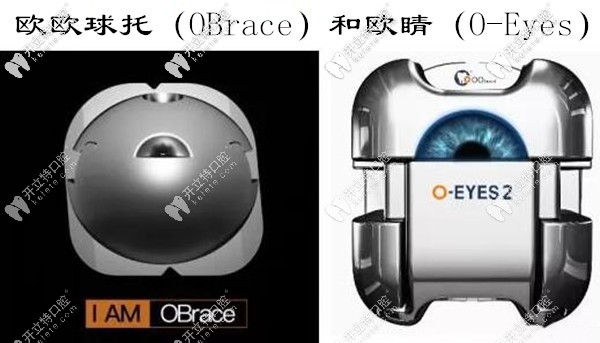歐睛(O-Eyes)球面金屬自鎖托槽牙齒矯正怎么樣