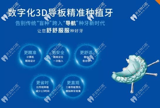 3d導板精準快速種牙