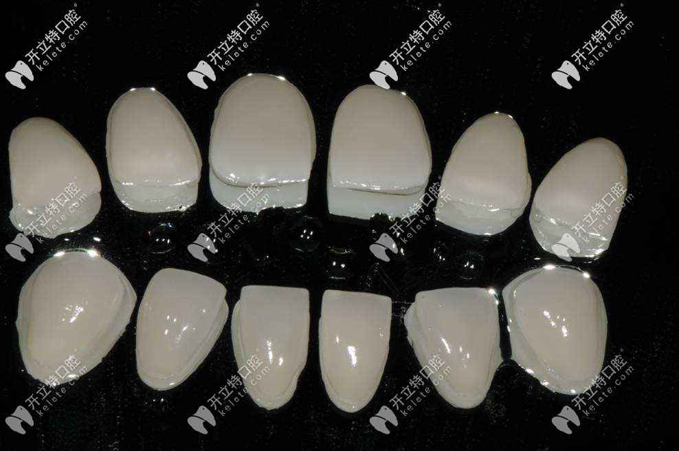 成都哪個醫(yī)院做牙齒貼面比較好