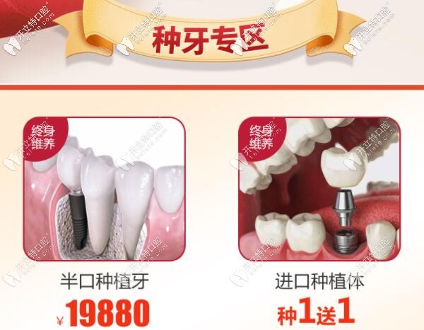 南寧柏樂口腔種植牙優(yōu)惠價(jià)格