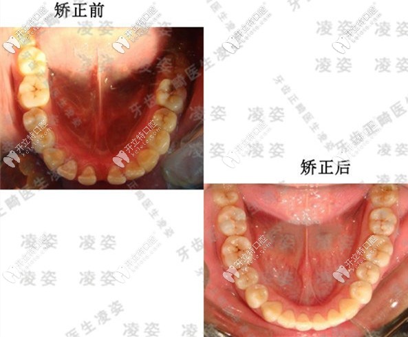 20200616684202.jpg 20200616684202.jpg