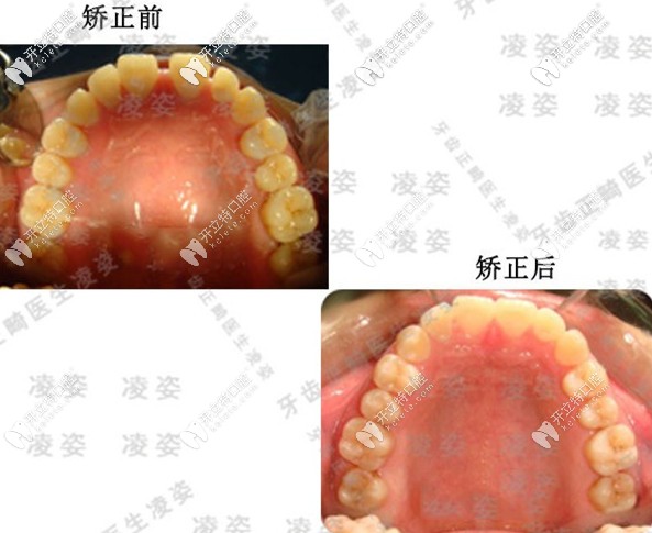 20200616950416.jpg 20200616950416.jpg